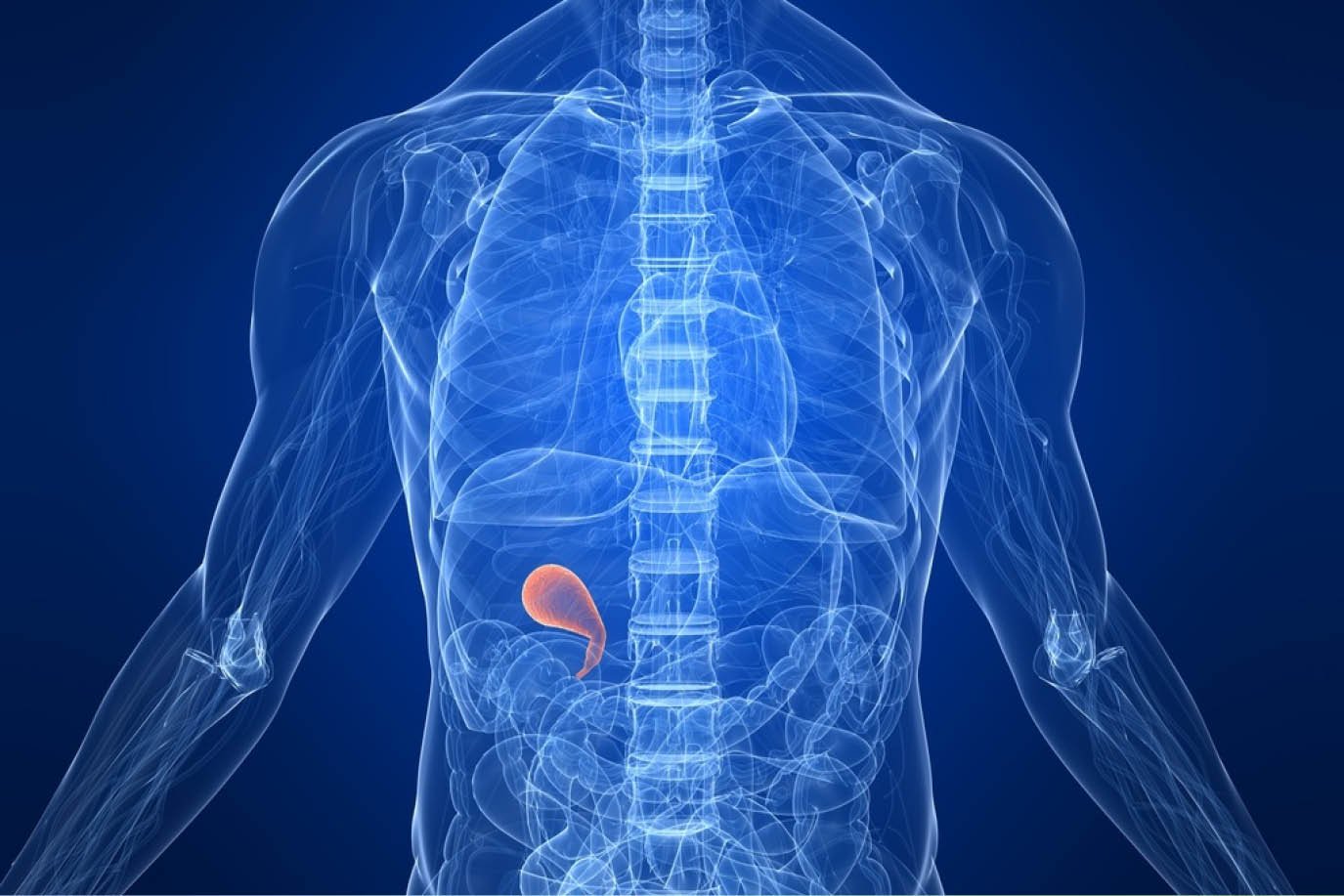 Cholecystectomy (Gallbladder)